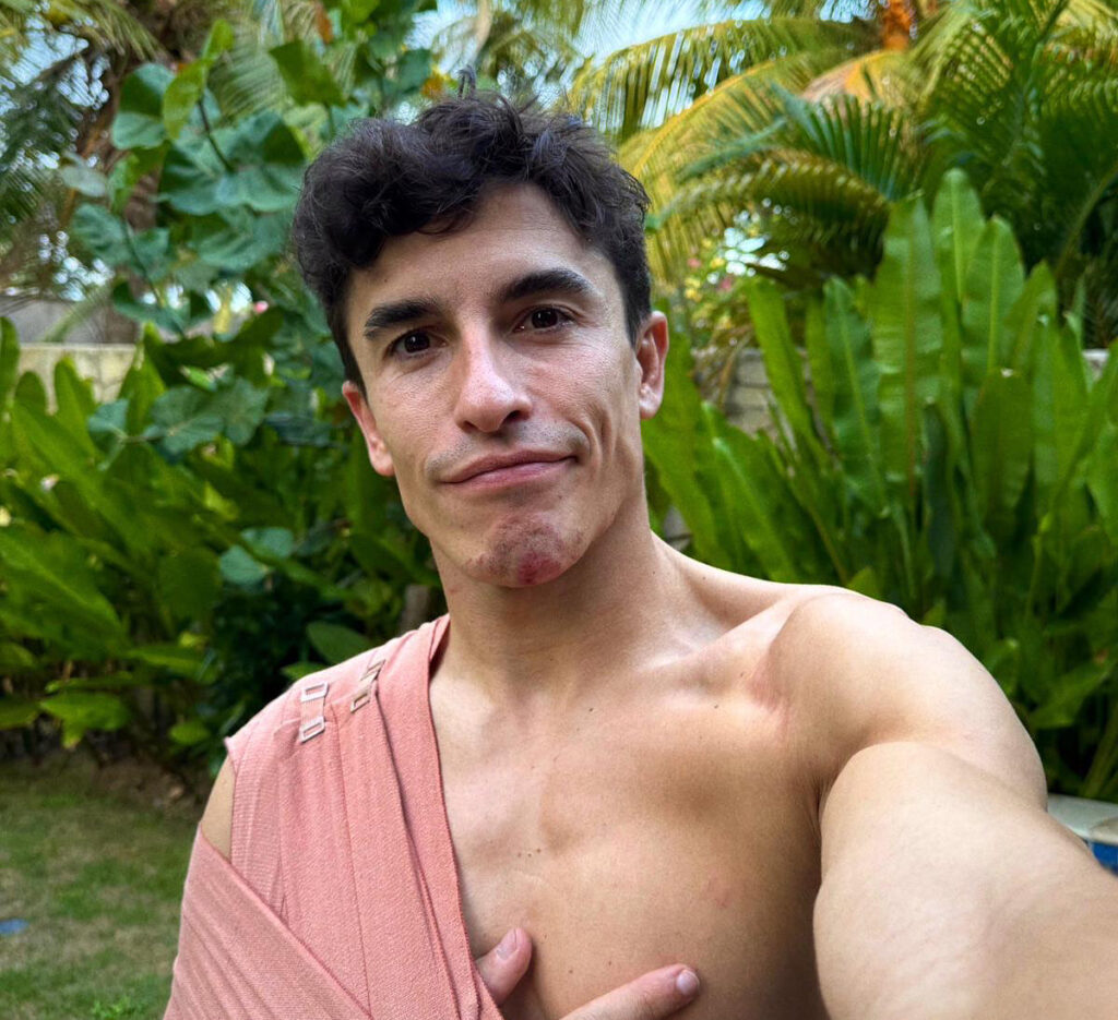 Márquez tiene fractura y lesión de ligamentos en el hombro derecho/Imagen: X (@marcmarquez93)